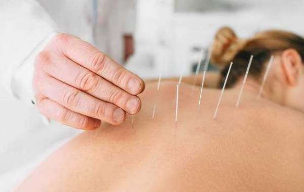 Acupuncture Market Scenario, Global Analysis By International Prestigious Players, Industry Demand and Trends by Forecas