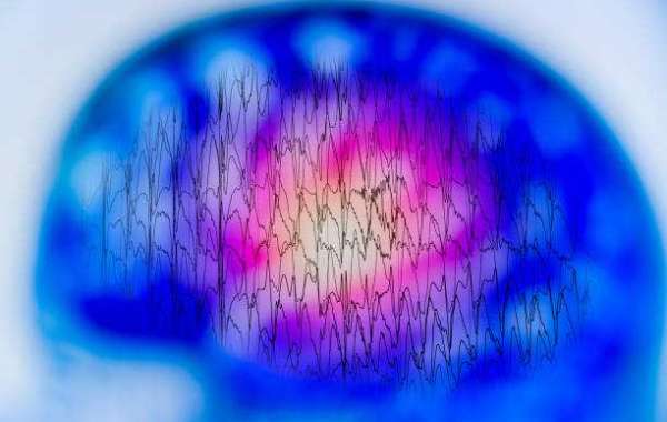 Unraveling the Mysteries of Epilepsy Through Genetic Testing: A Comprehensive Guide